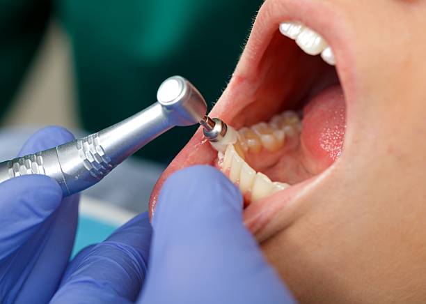 Best Dental Exams and Cleanings  in USA